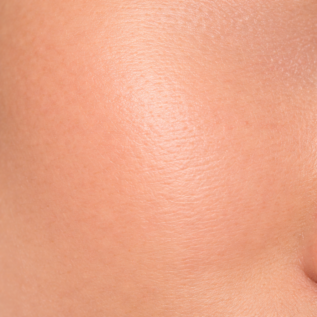 Peaux normales